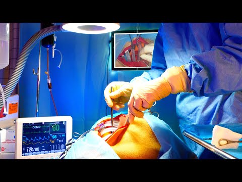 ASMR Hospital Heart Surgery for Gunshot Wound | Medical Role Play