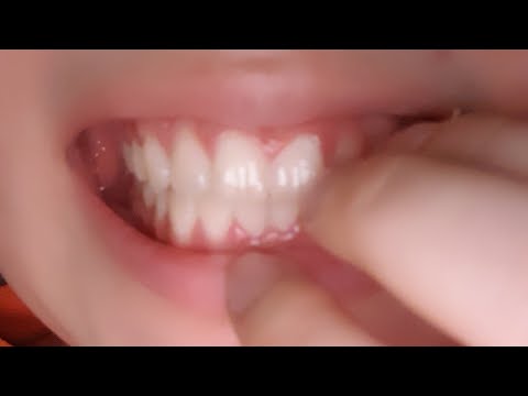 [ASMR] teeth tapping sound / 이 두들기는 소리 46초...