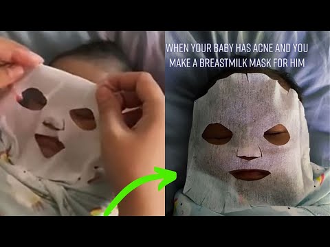 Mom Makes Breast Milk Face mask for Newborn Baby Acne & to bond Viral Tiktok @ahlingaling