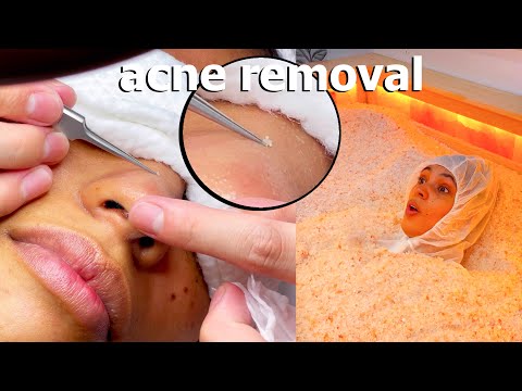 ASMR: Relaxing Japanese ACNE REMOVAL TREATMENT with HOT SALT BATH!