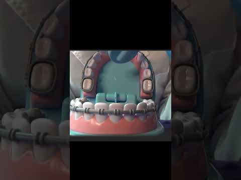ASMR Short Dentist POV Clip