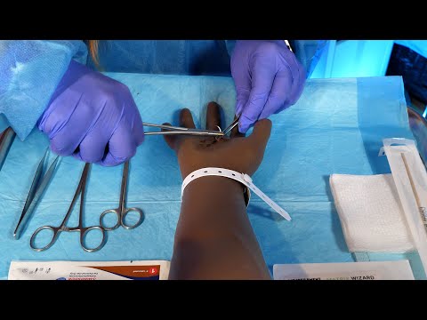ASMR Hospital Getting Stitches in the ER | Suturing, Head Exam