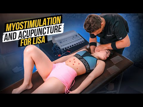 UNIQUE CHINESE MEDICINE TECHNIQUES FOR DEEP BACK MASSAGE | ACUPUNCTURE AND MYOSTIMULATION FOR LISA