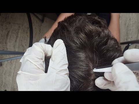 ASMR - REAL PERSON Scalp Check Up & Treatment *Trigger Sounds*