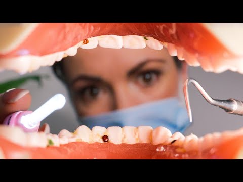 [ASMR] Dentist Exam & Teeth Cleaning 🦷 (In The Mouth POV)