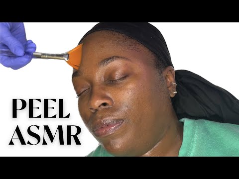 “P” IS FOR PEACE OUT PIGMENT! PIGMENTATION PEEL ASMR