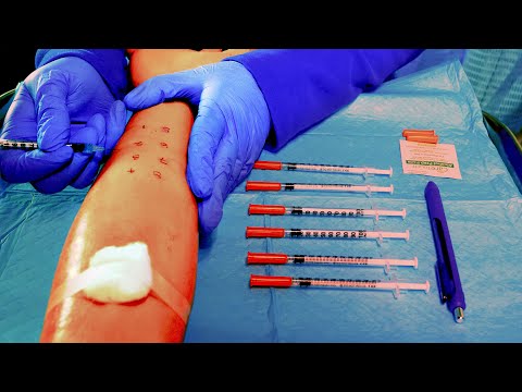 ASMR Hospital Allergy Testing | Intradermal & Drop Test | Medical Role Play