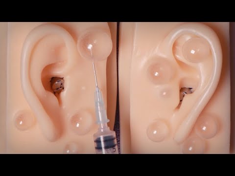 ASMR 귀에 물집 만들고 터뜨리는 이상하고 희한한 자극적 귀 주사│To blister and pop in the ear│Ear wind blowing INJECTION