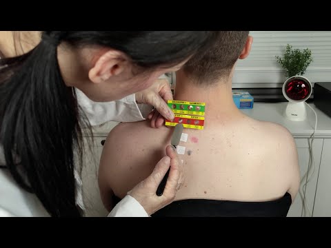 Allergy Skin Test & Check Up On The Back [ASMR] *Annual Doctor Visit*