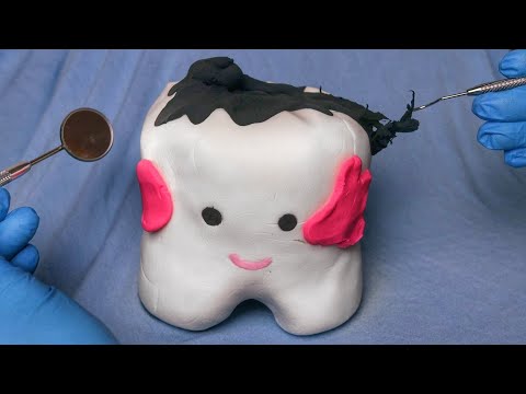 ASMR: DENTISTA REMOVENDO SUA CÁRIE  - Sweet Carol