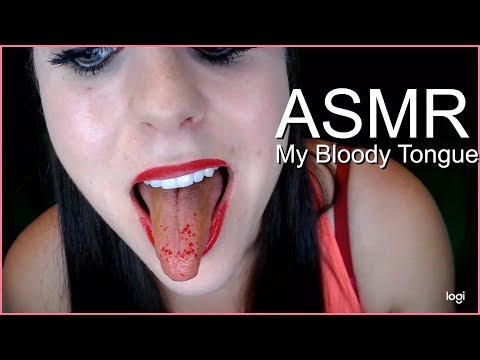 My bleeding tongue