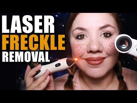 ASMR 💥 Laser Freckle Removal RoIePIay 💥 (With Real Sounds)