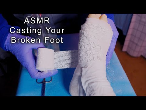 ASMR Hospital Placing a Cast on Your Broken Foot | Medical Role Play
