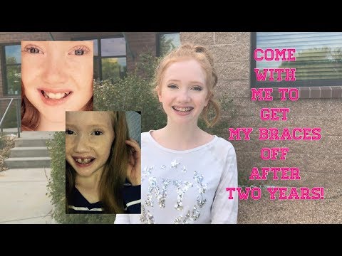 Come With Me To Get My Braces Off!!!