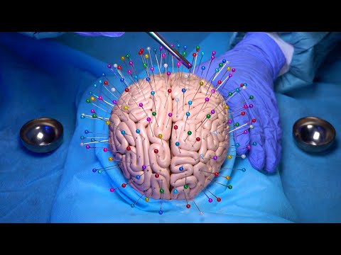 ASMR Removing Sharp Pins Stuck In Your Brain! Negative Energy Removal 🧠