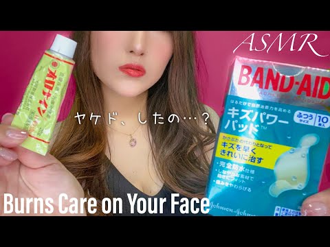 ASMR 顔のヤケドを手当てする姉ロールプレイ - Your Sister Tends to Your Burns on Your Face.