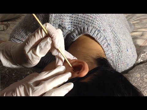 HOW TO GIVE MAJOR ASMR TIINGLES Ear Cleaning Tutorial w. Sticky Q-tips, Wooden Pick (Soft Spoken)
