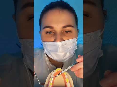 ASMR ROLEPLAY : une dentiste soigne tes caries 🦷 #shorts
