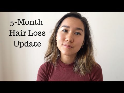 Androgenetic Alopecia Update: Hair Growth and Natural Treatments (Female Pattern Hair Loss Series)