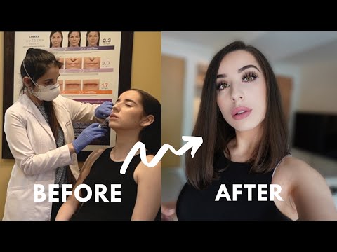 ASMR | All About My Lip Injections 💉