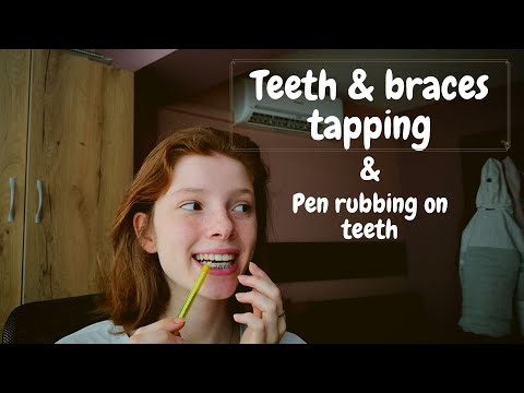 ASMR | FAST teeth and braces tapping + Pen rubbing against teeth and braces