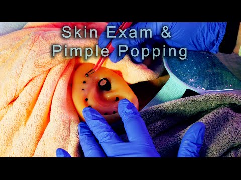 ASMR Dermatologist Exam | Pimple Popping, Extraction Role Play