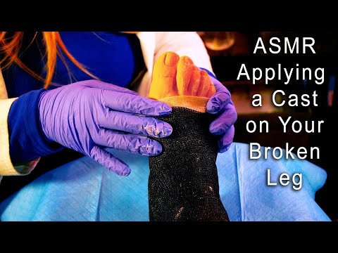 ASMR Applying a Cast on Your Broken Leg | Medical Role Play