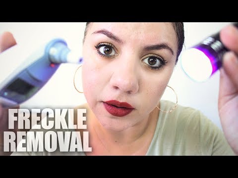 FRECKLE Removal Treatment ASMR Role Play