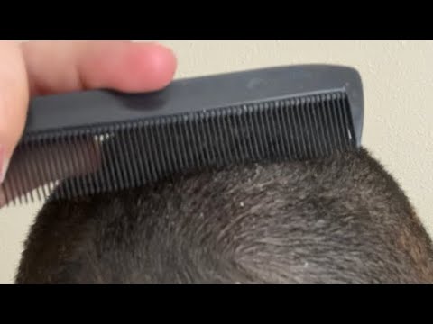 Dry scalp scratching