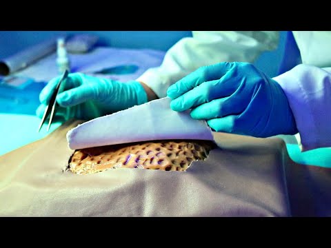 ASMR CIRÚRGICO | DOANDO SEUS ÓRGÃOS 🫁🫀🧠 (surgery hospital)