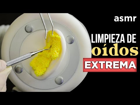 ASMR Español Te hago una LIMPIEZA de OÍDOS EXTREMA en ASMR (ASMR Ear Cleaning) - ASMR - ASMR Español